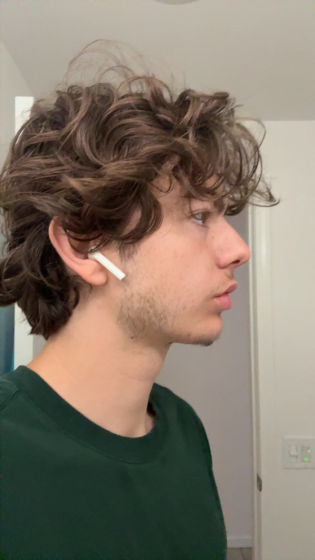 What surgery should I get for my jaw — before and after photo — Cosmetic Surgery on GlowUps
