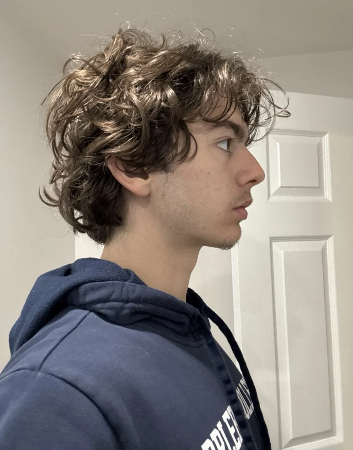 What surgery should I get for my jaw — before and after photo — Cosmetic Surgery on GlowUps