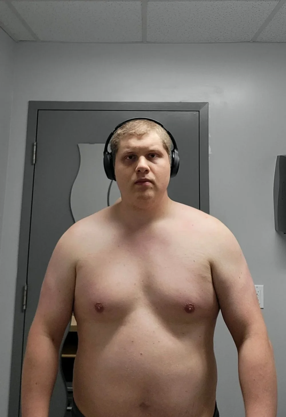 2 Year Gym Transformation — before and after photo — Bodybuilding on GlowUps