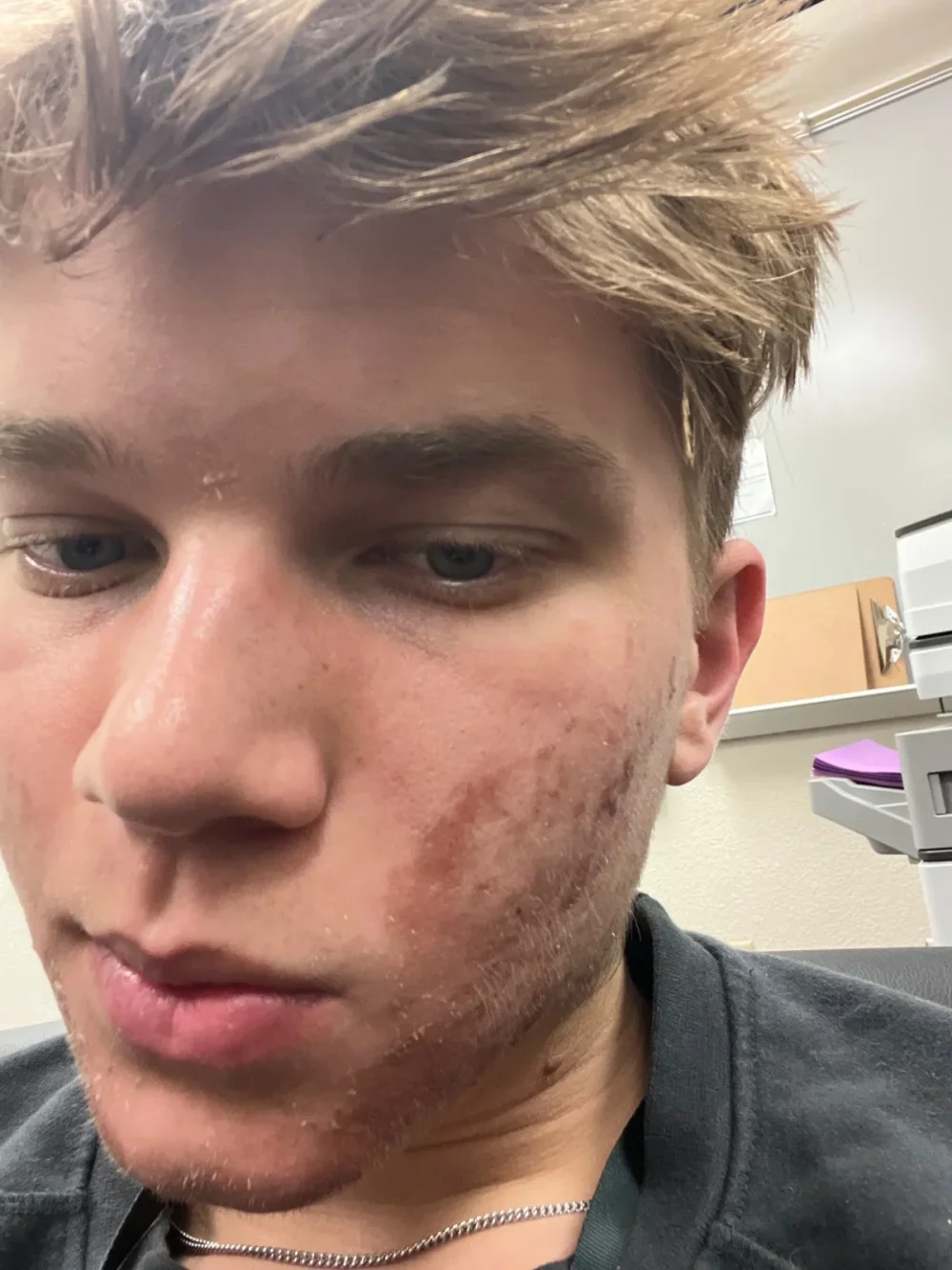 7 months in so far, still looking for some tips. — before and after photo — General Glowups on GlowUps