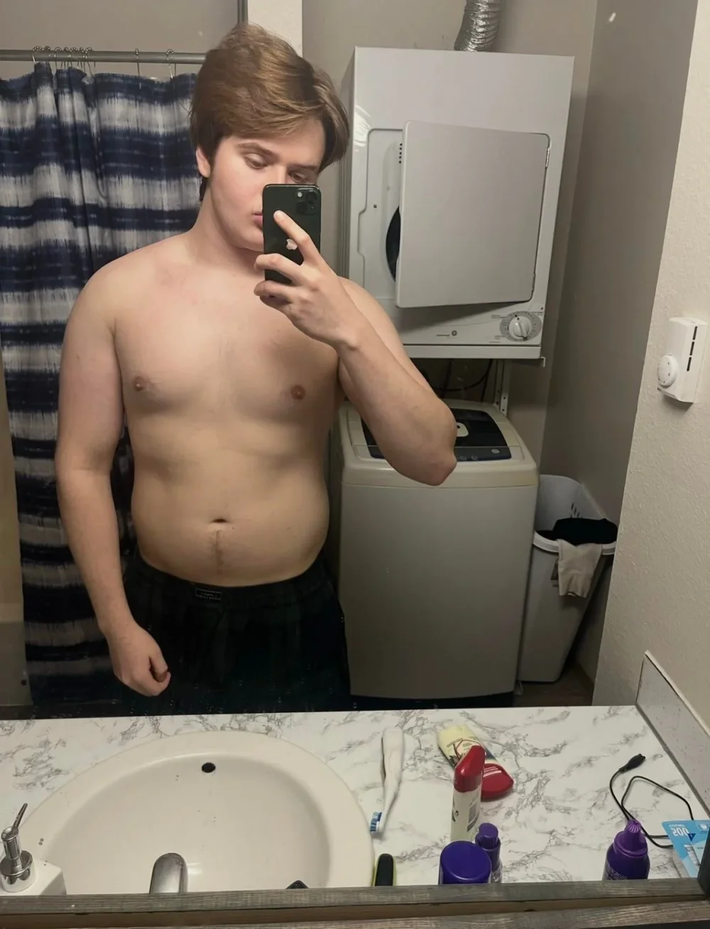 18-21 / 205lbs -> 148 — before and after photo — Bodybuilding on GlowUps